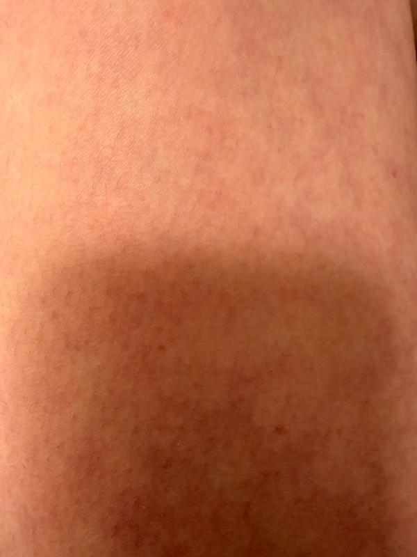 Review Thumbnail Image 1 383410403