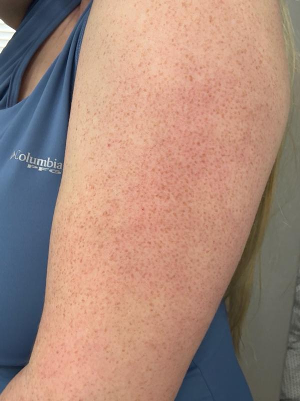 Review Thumbnail Image 1 382805316