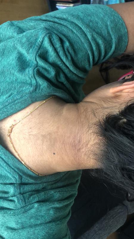 After using for 2/3 months (behind my neck)