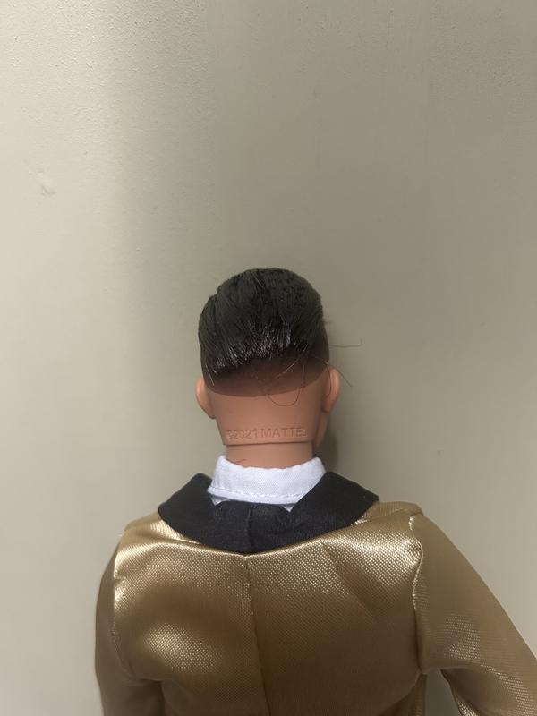 Weird hairline with stray hairs