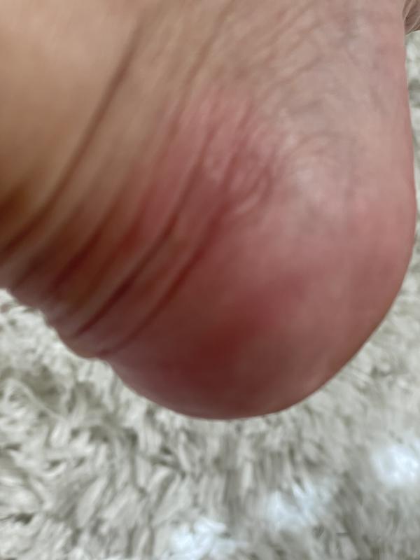 Customer photo for "Danger I had to work without shoes the rest of day"