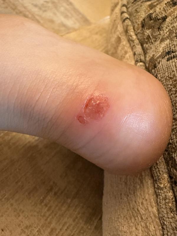 Customer photo for "Very uncomfortable"