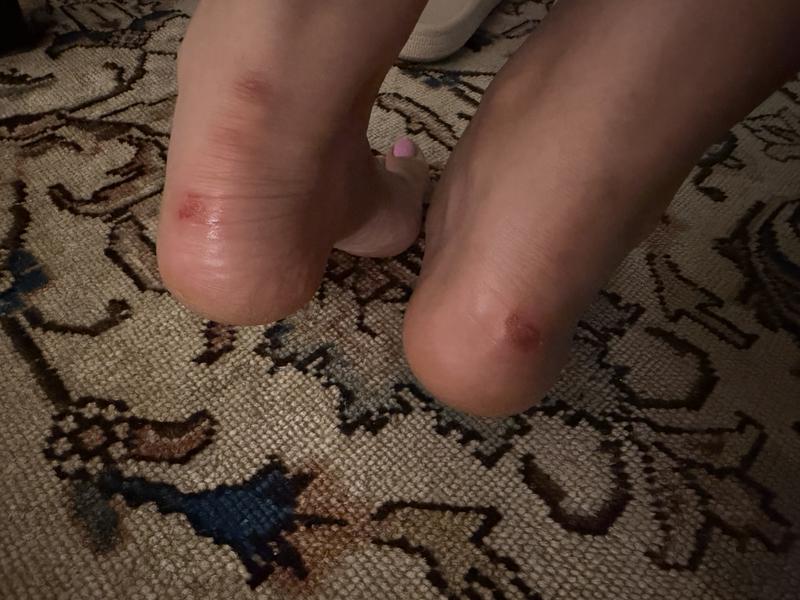 Customer photo for "Very uncomfortable"