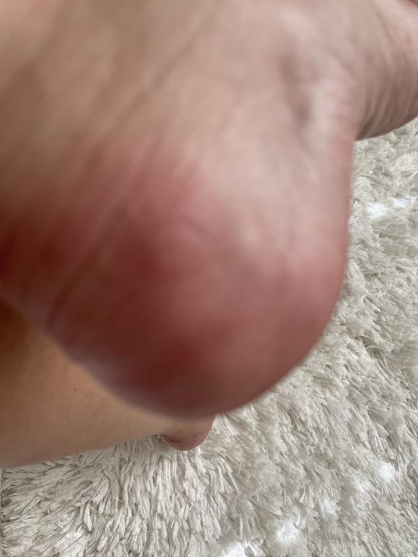Customer photo for "Danger I had to work without shoes the rest of day"