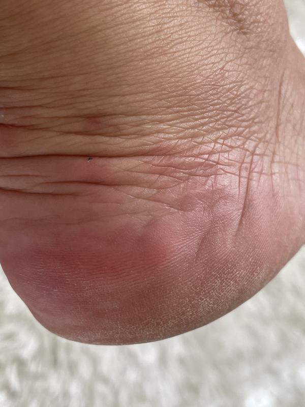 Customer photo for "Danger I had to work without shoes the rest of day"