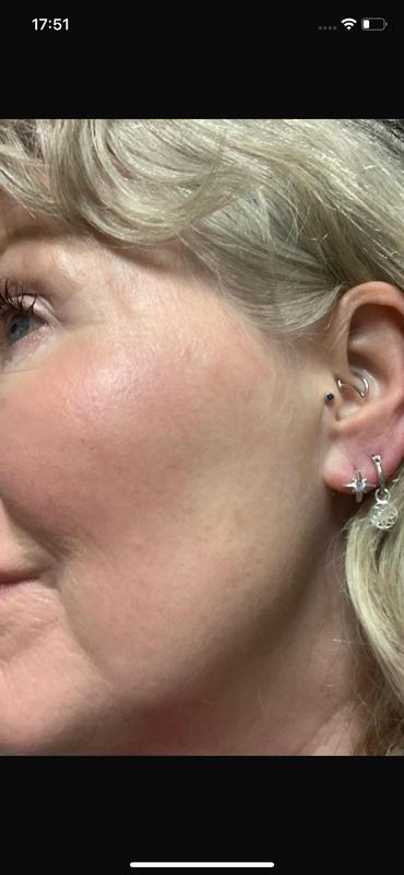 Customer photo for "Has transformed my 60 yr old skin"