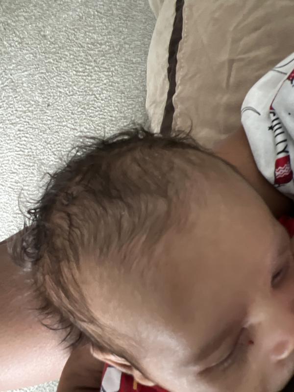 After use hair growing back