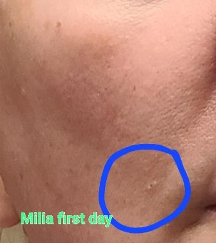 Customer photo for "Coconut Renewal AHA Toner"