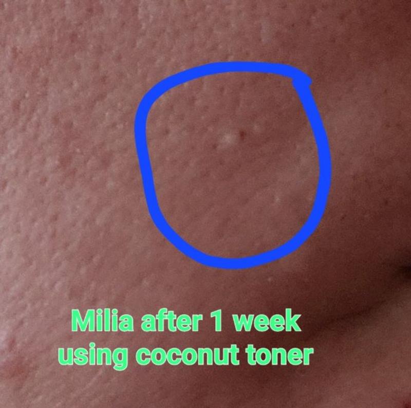 Customer photo for "Coconut Renewal AHA Toner"