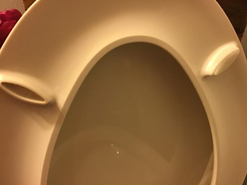 Kohler Toilet Seat Replacement Bumpers Velcromag