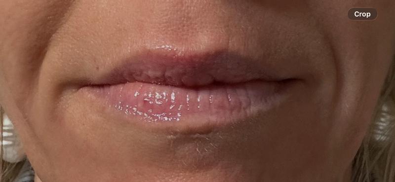 Review Thumbnail Image 1 383536488