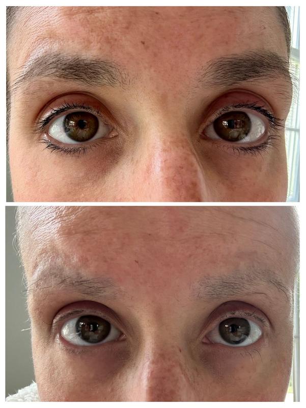 Review Thumbnail Image 0 358610203