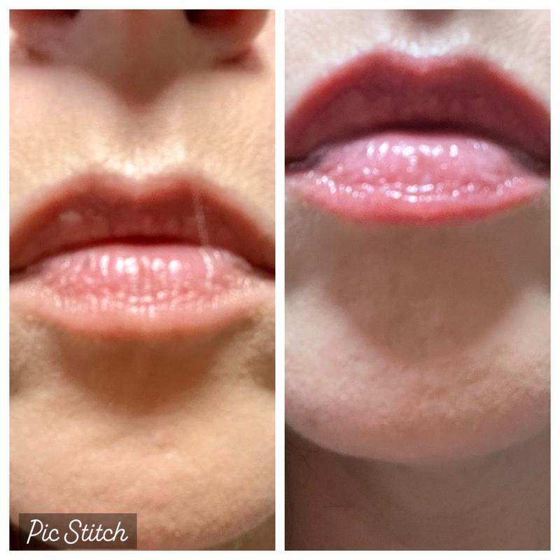 Review Thumbnail Image 0 383237265