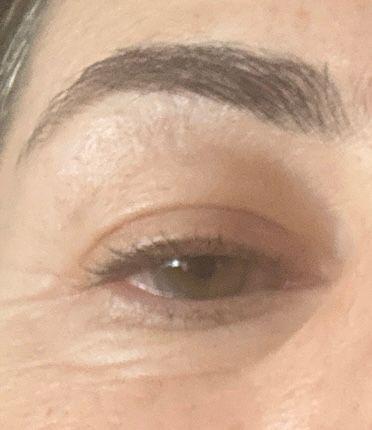 Customer photo for "Brow enhancement"
