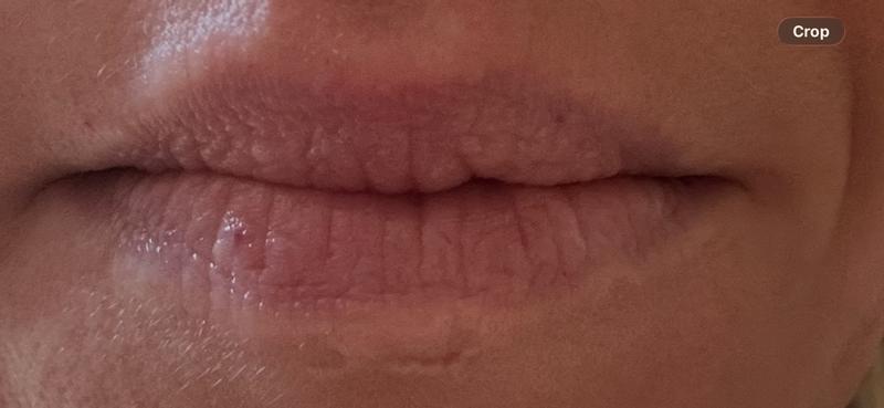 Review Thumbnail Image 0 383536488