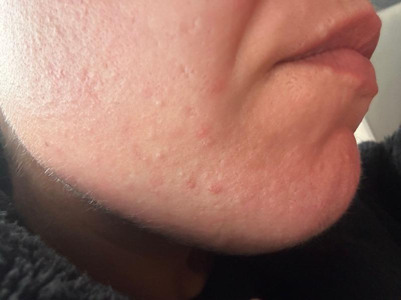 Customer photo for "Warning... avoid at all costs"