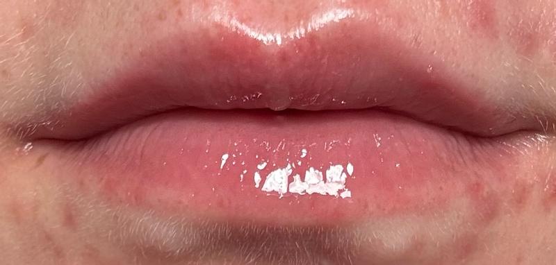 Review Thumbnail Image 0 383615587