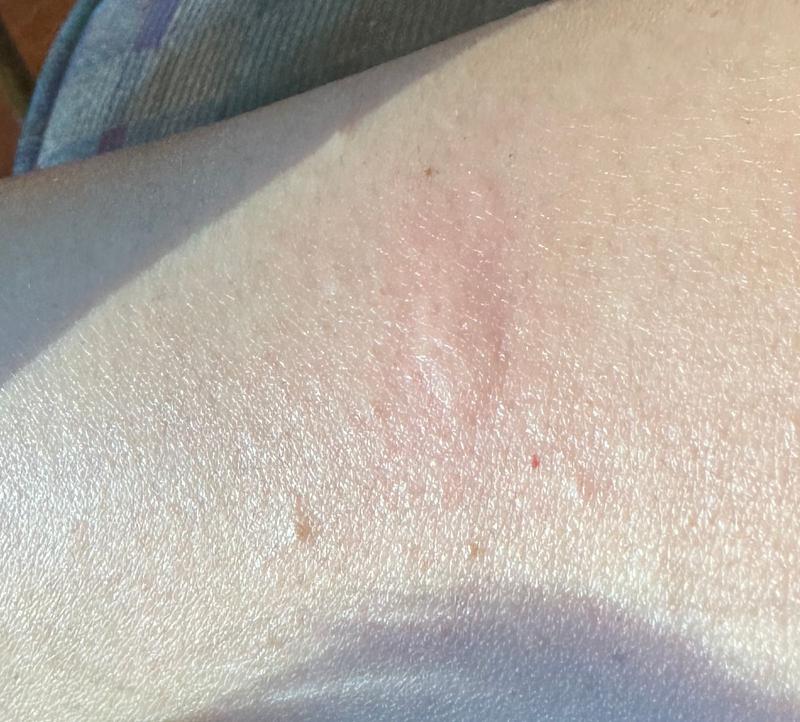 Customer photo for "Didn’t work for me at all!"