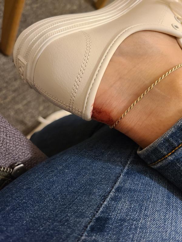 Customer photo for "Nice sneaker but uncomfortable"