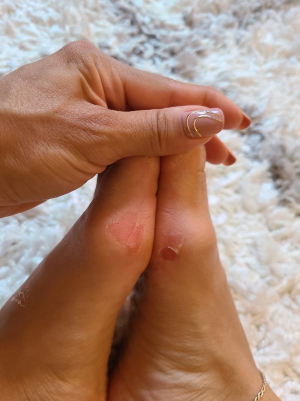 Customer photo for "HORRIBLE SHOES"
