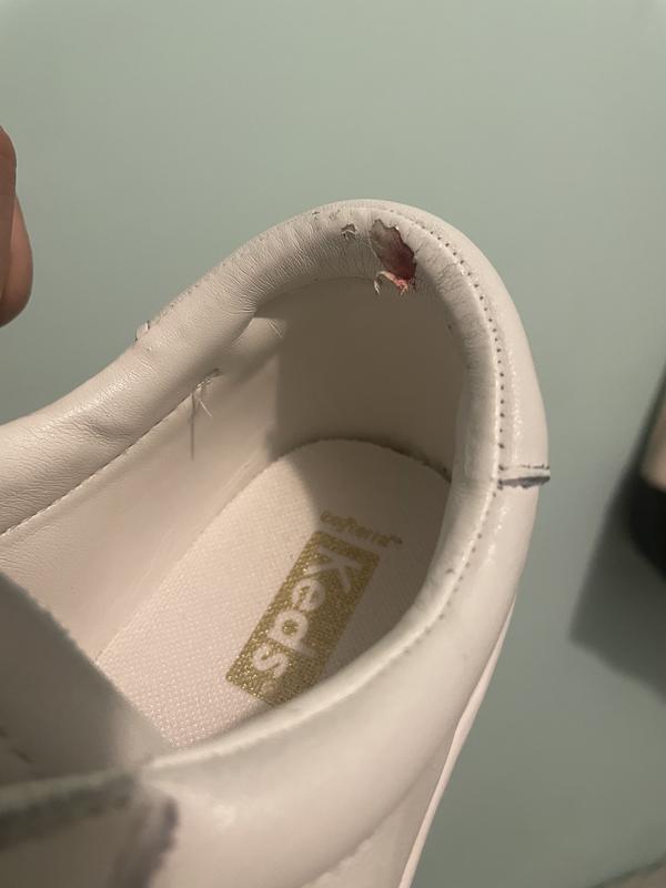 They also caused me blisters