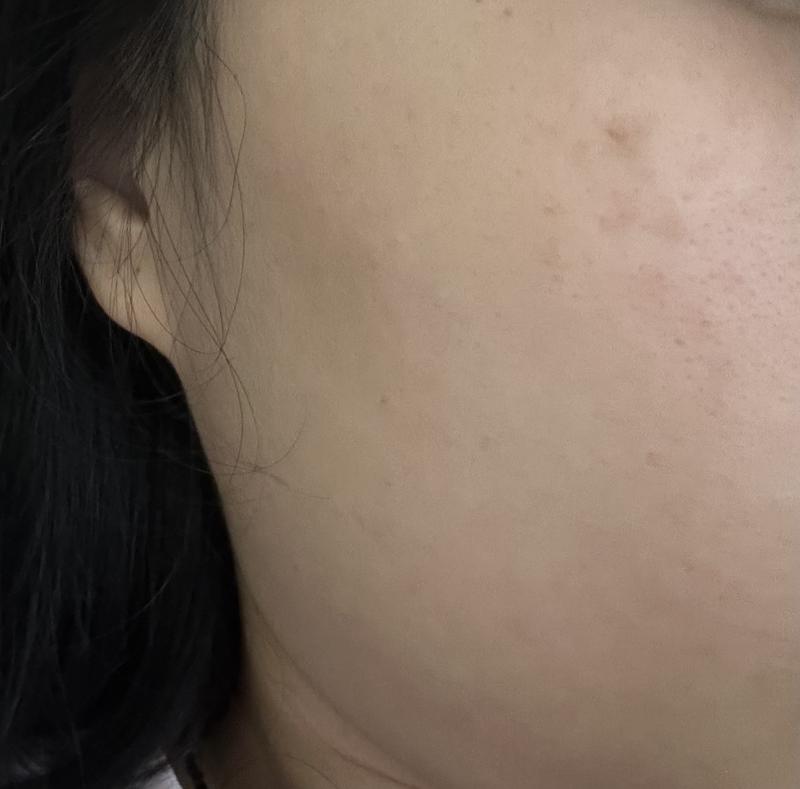 My skin after one month using