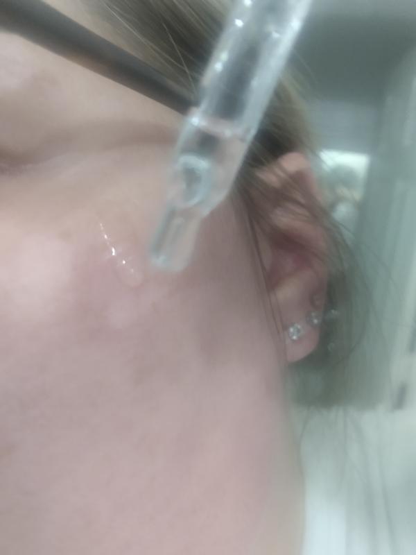 Drops of youth!!! Glowing skin