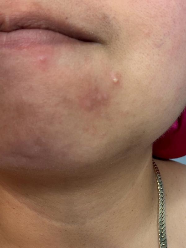 Review Thumbnail Image 1 383114751