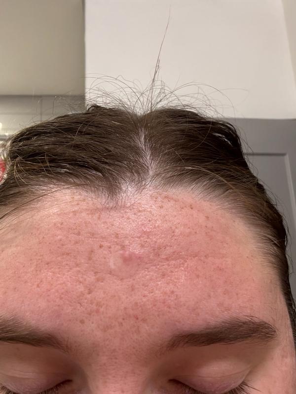 Review Thumbnail Image 1 384974487