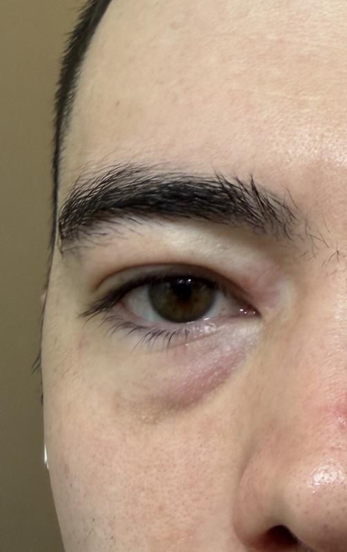 Customer carousel item 1.