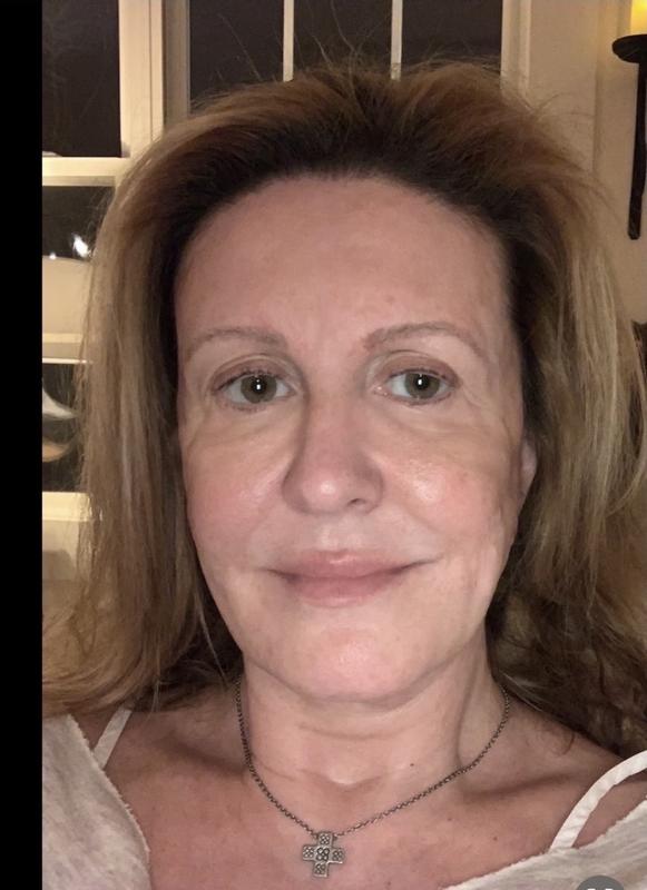 Two befores and one after