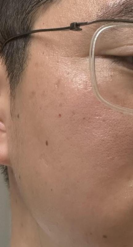 MY SKINLOOKS 5 YEARS YOUNGER AFTER 2 MONTH OF USED