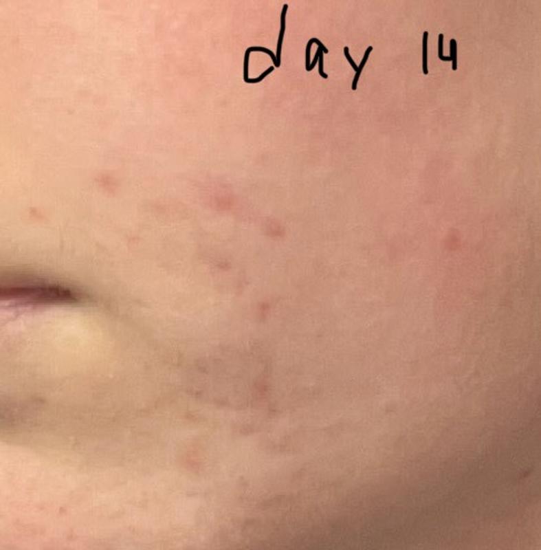 Customer photo for "It works okay"