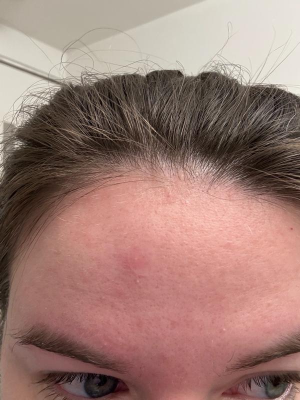 Review Thumbnail Image 0 382441973