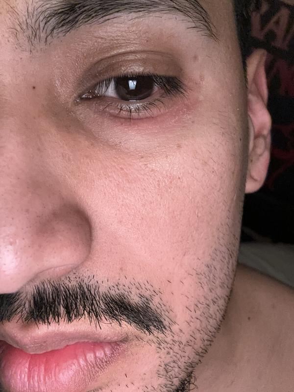 Photo from Sad eyes