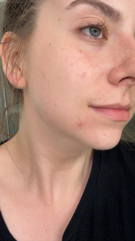 Review Thumbnail Image 1 383551723