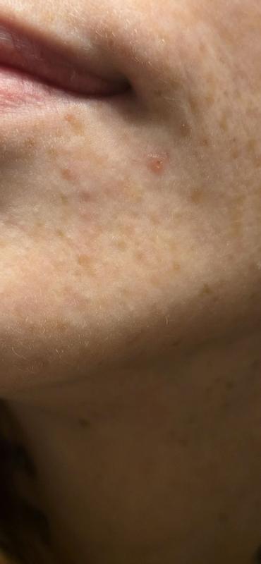 Review Thumbnail Image 1 381784527