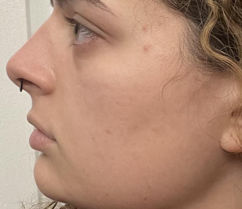 The morning after using products.