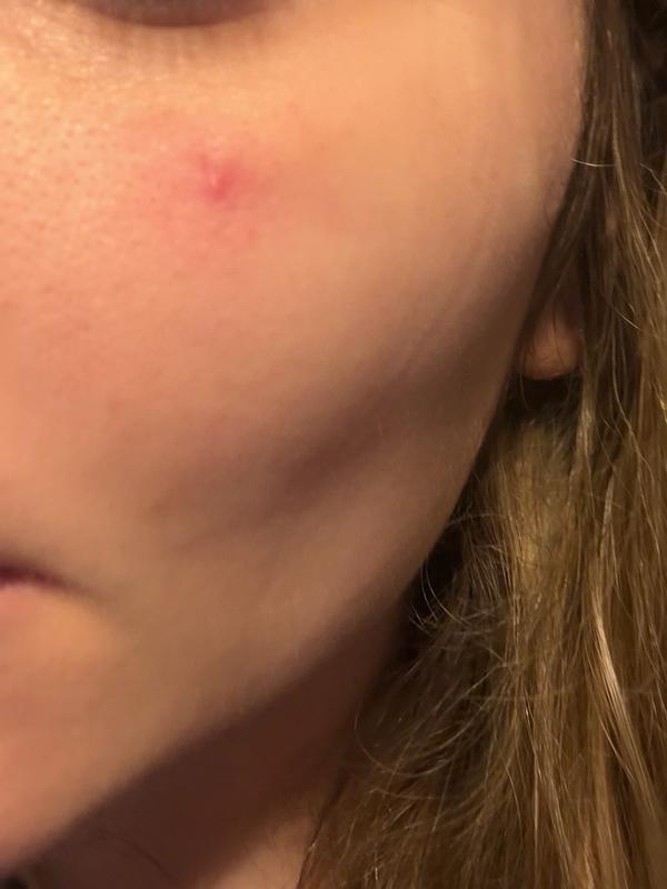 Review Thumbnail Image 2 383161371