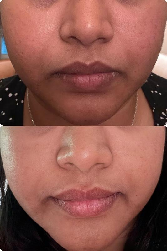 Review Thumbnail Image 3 382055299