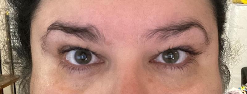 No crows feet, improved look of dark circles