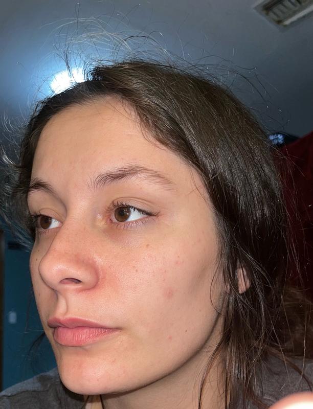 Review Thumbnail Image 0 383619315