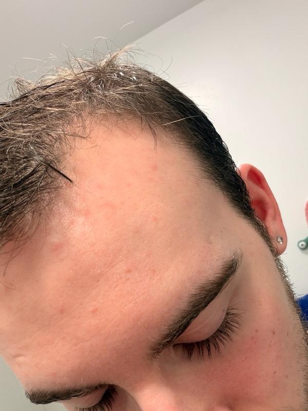 Review Thumbnail Image 0 382672839