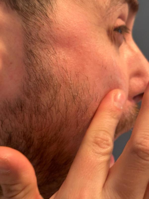 Review Thumbnail Image 2 383464486