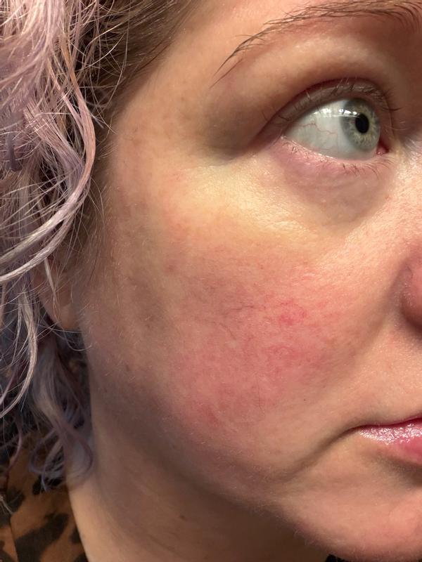 Customer carousel item 9.