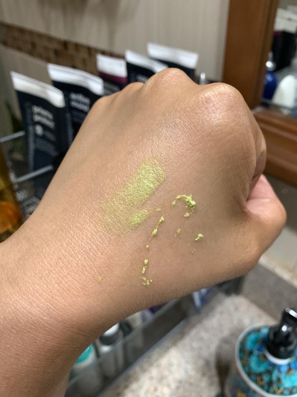 Customer photo for "This Product Definitely Solved My Skin Concerns!"