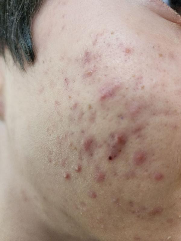 Review Thumbnail Image 0 383607033