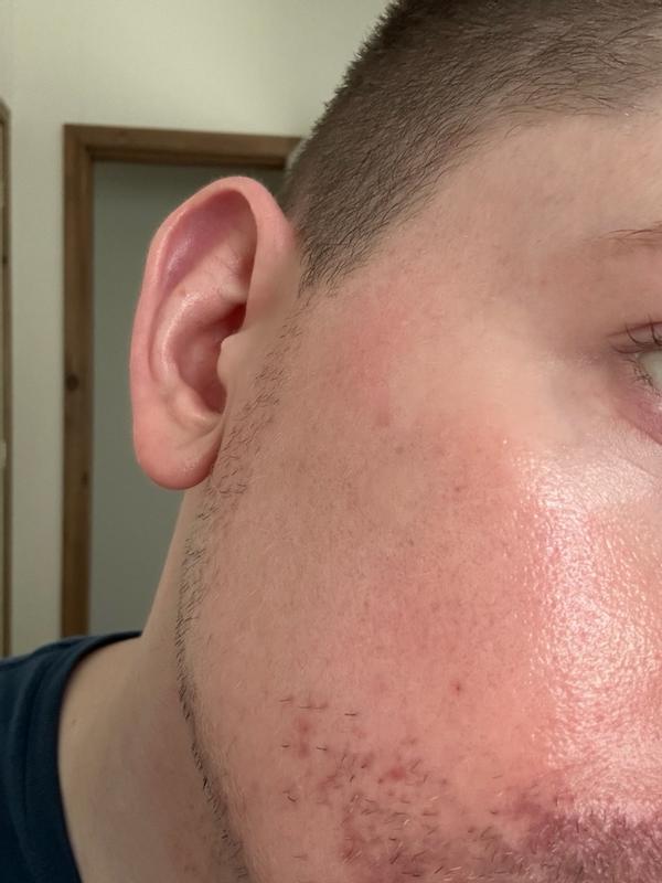 Customer carousel item 13.