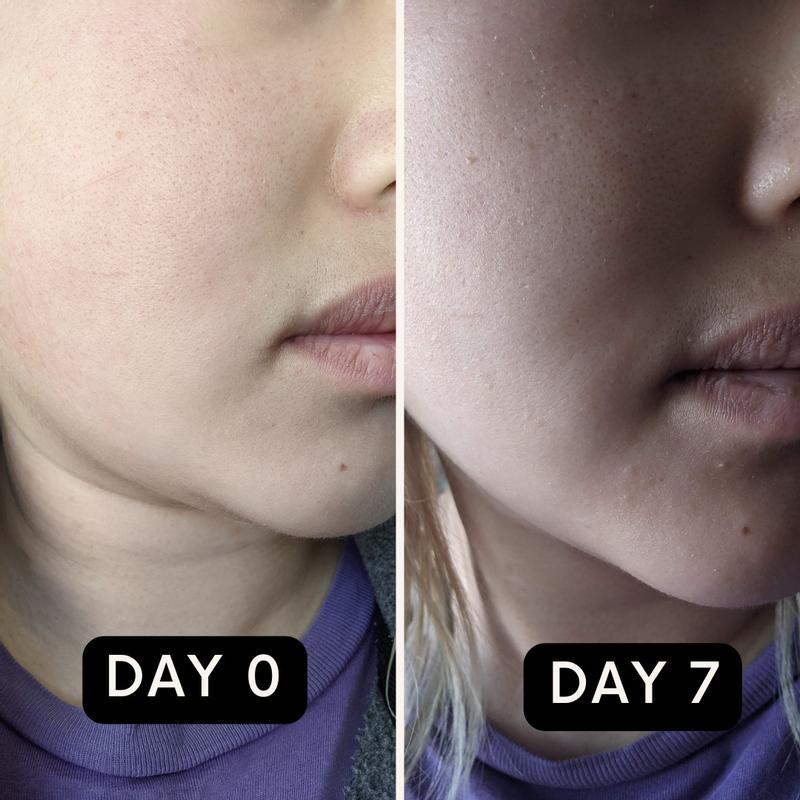 Day 0 vs. Day 7 comparison