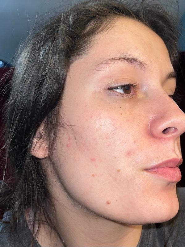 Review Thumbnail Image 1 383619315